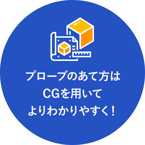 プローブのあて方はCGを用いてよりわかりやすく！